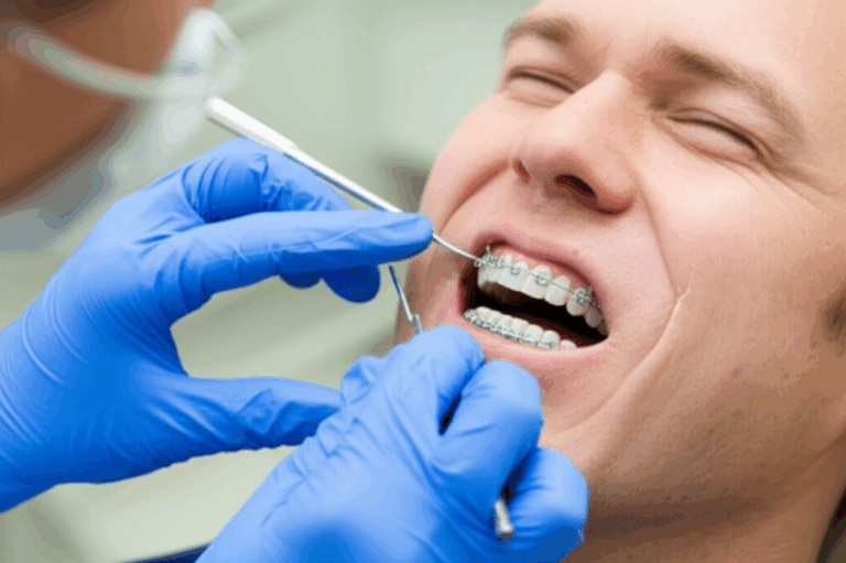 Can Your Dentist Do Braces My Personal Journey and All You Should Know