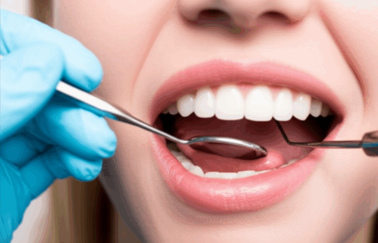 Can a Dentist Treat Mouth Ulcers My Personal Guide to Professional Help and Relief